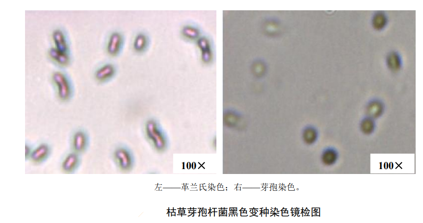 Microscopic examination of Bacillus subtilis var. black Microscopic examination of Bacillus subtilis var. black